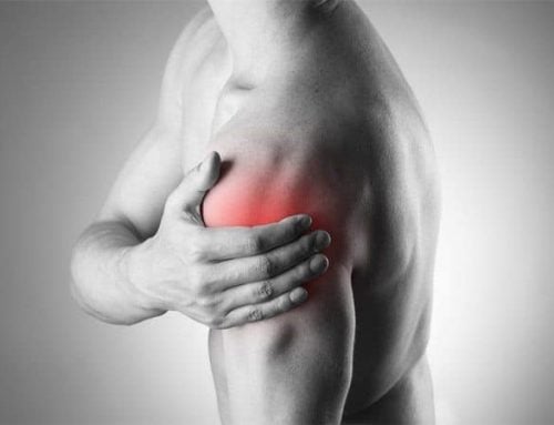 Sore Shoulder: Smart Recovery and At-Home Rehab